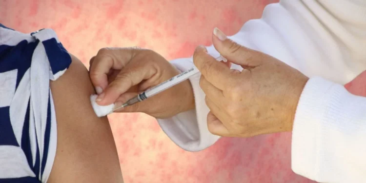 Exhortan autoridades de Salud a vacunarse contra el sarampión; en análisis probable  caso